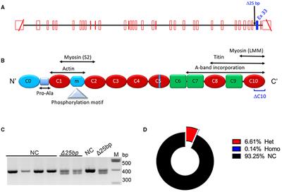 South Asian-Specific MYBPC3Δ25bp Deletion Carriers Display Hypercontraction and Impaired Diastolic Function Under Exercise Stress